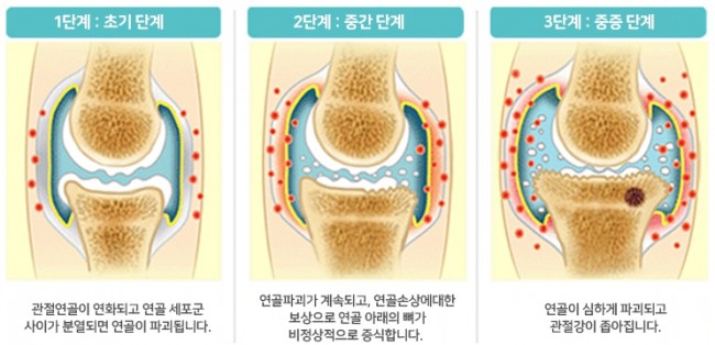 동향분석-img-06.jpg